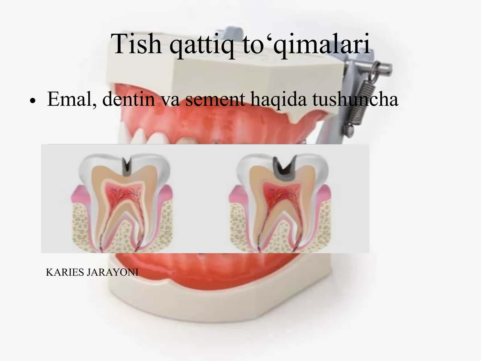 Tish qattiq to‘qimalarini charxlash bosqichlari va tamoyillari 2