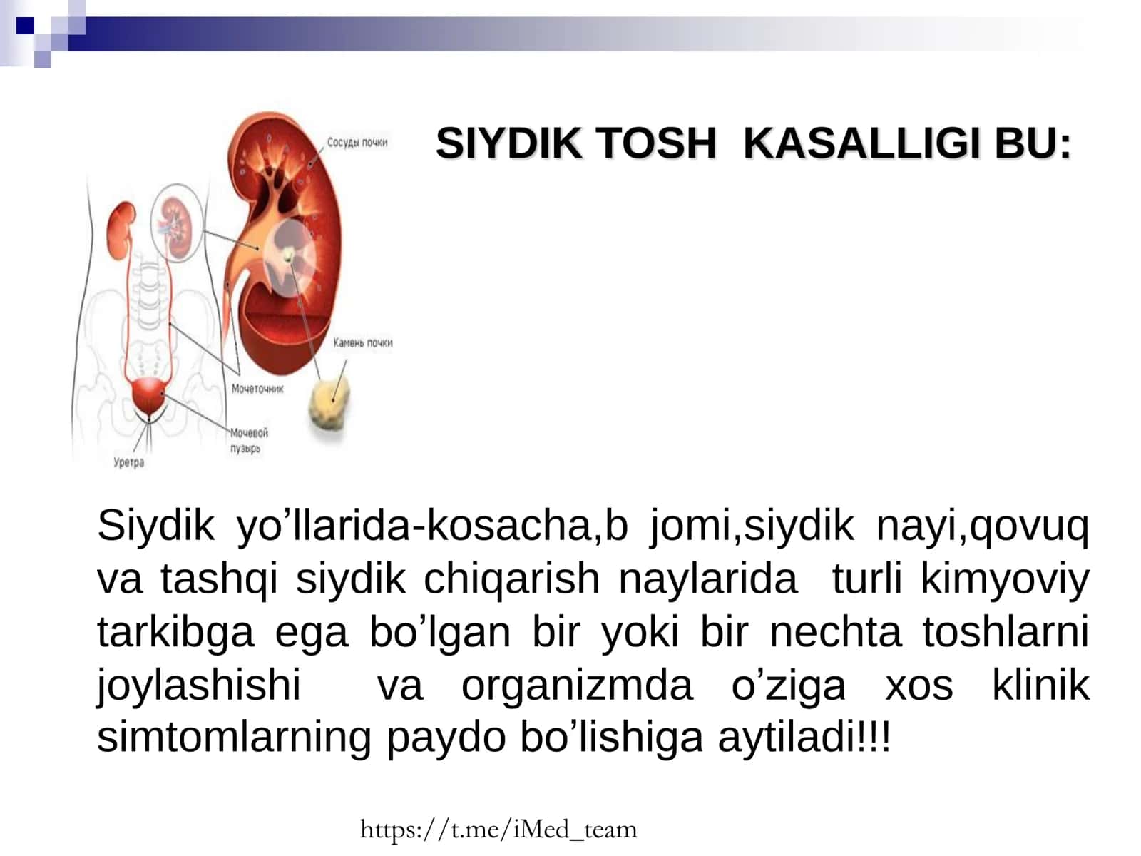 SIYDIK TOSH KASALLIGI 2