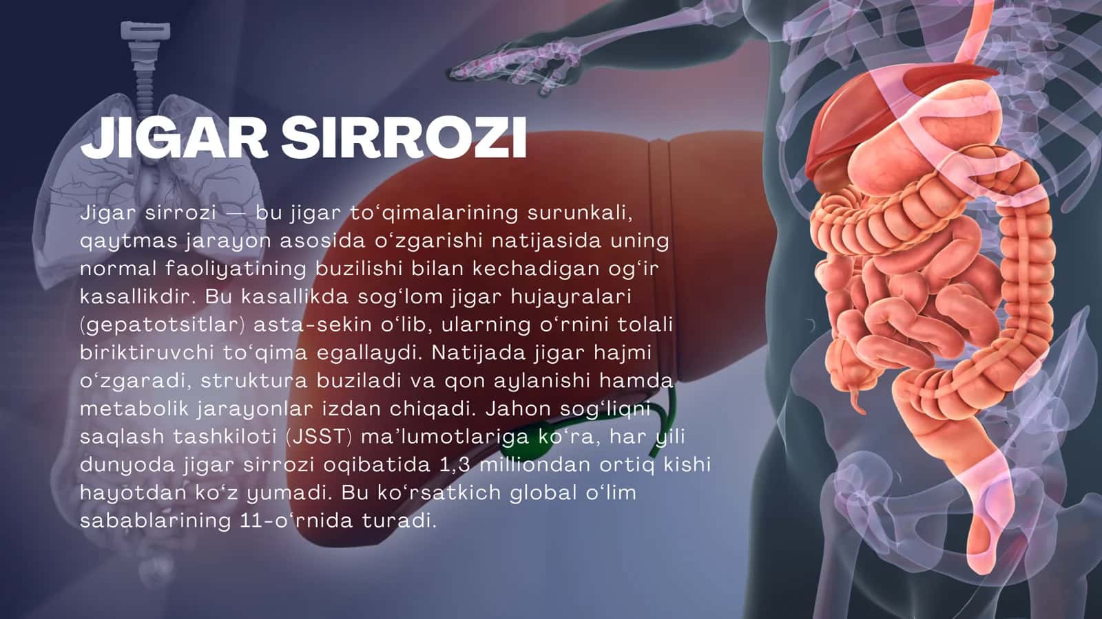 Jigar sirrozi 2