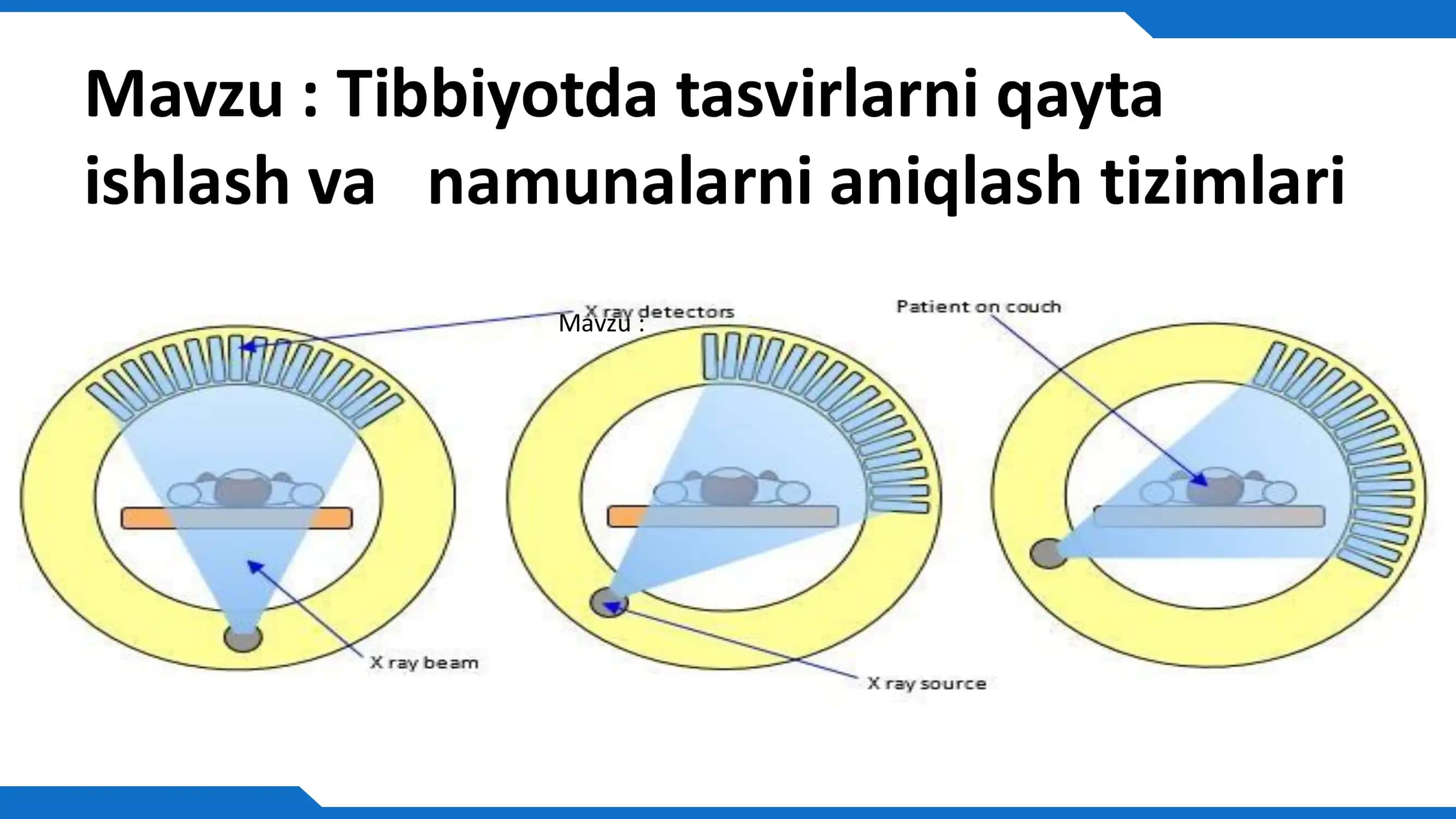Tibbiyotda tasvirlarni qayta ishlash va namunalarni aniqlash tizimlari 2