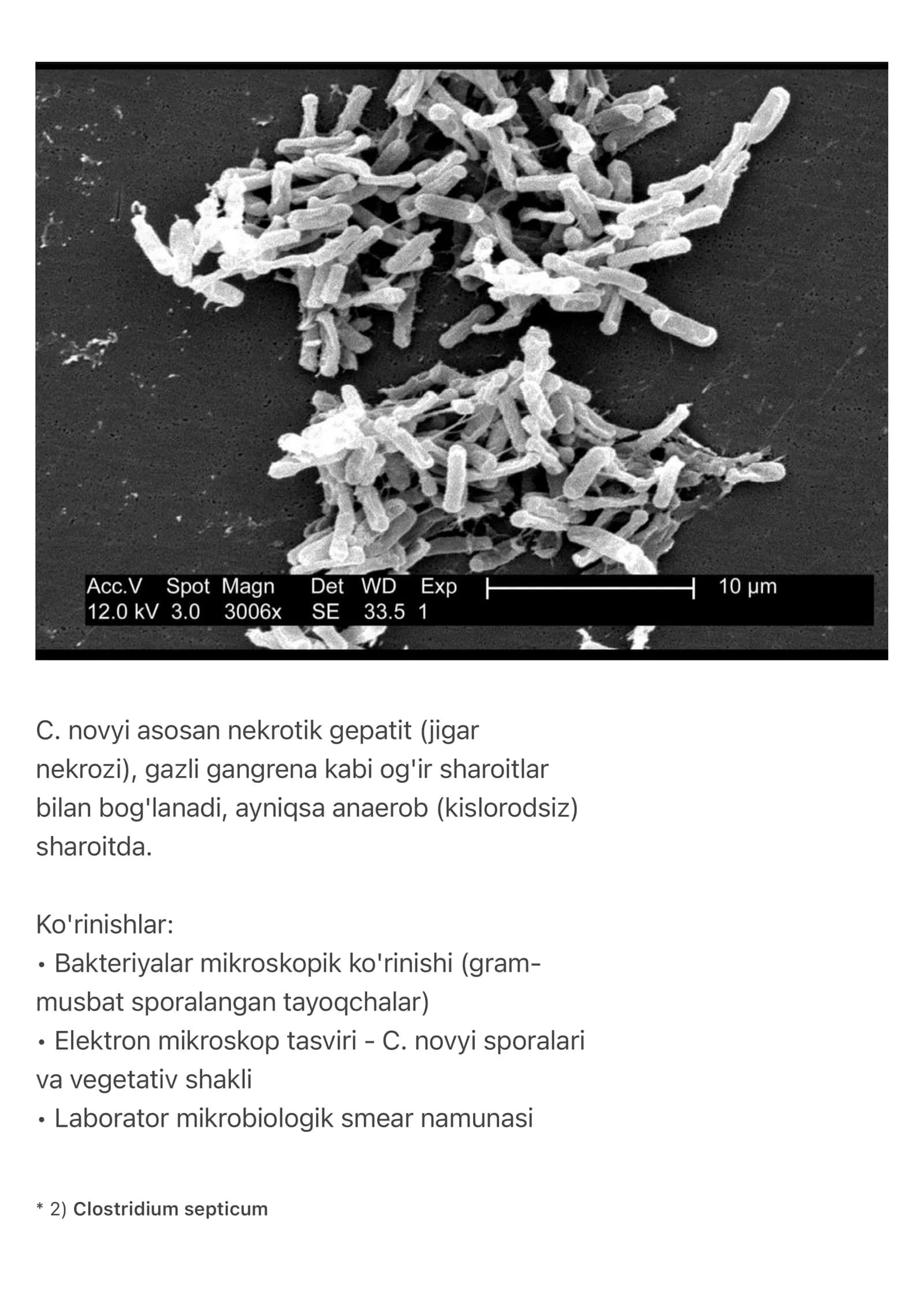 Clostridium novyi infeksiyasi 2