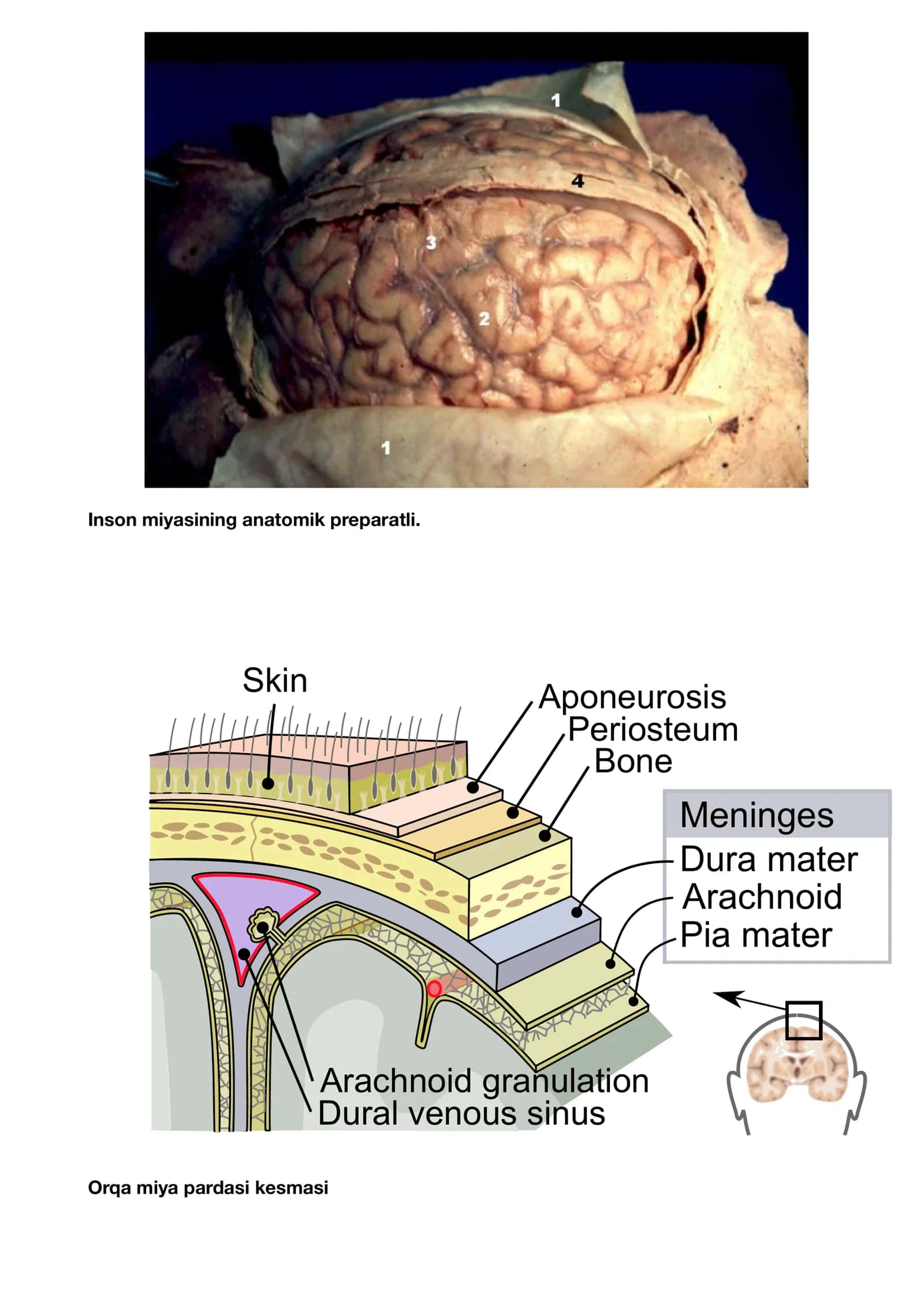 Inson miyasining anatomik preparati 2