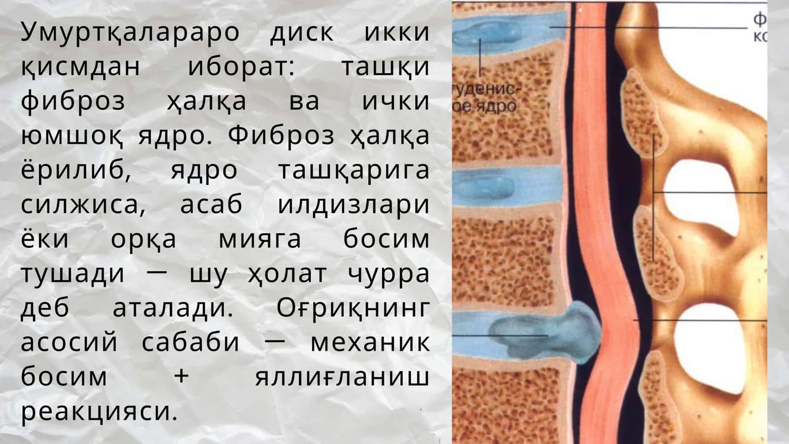Умуртка чурраси 2