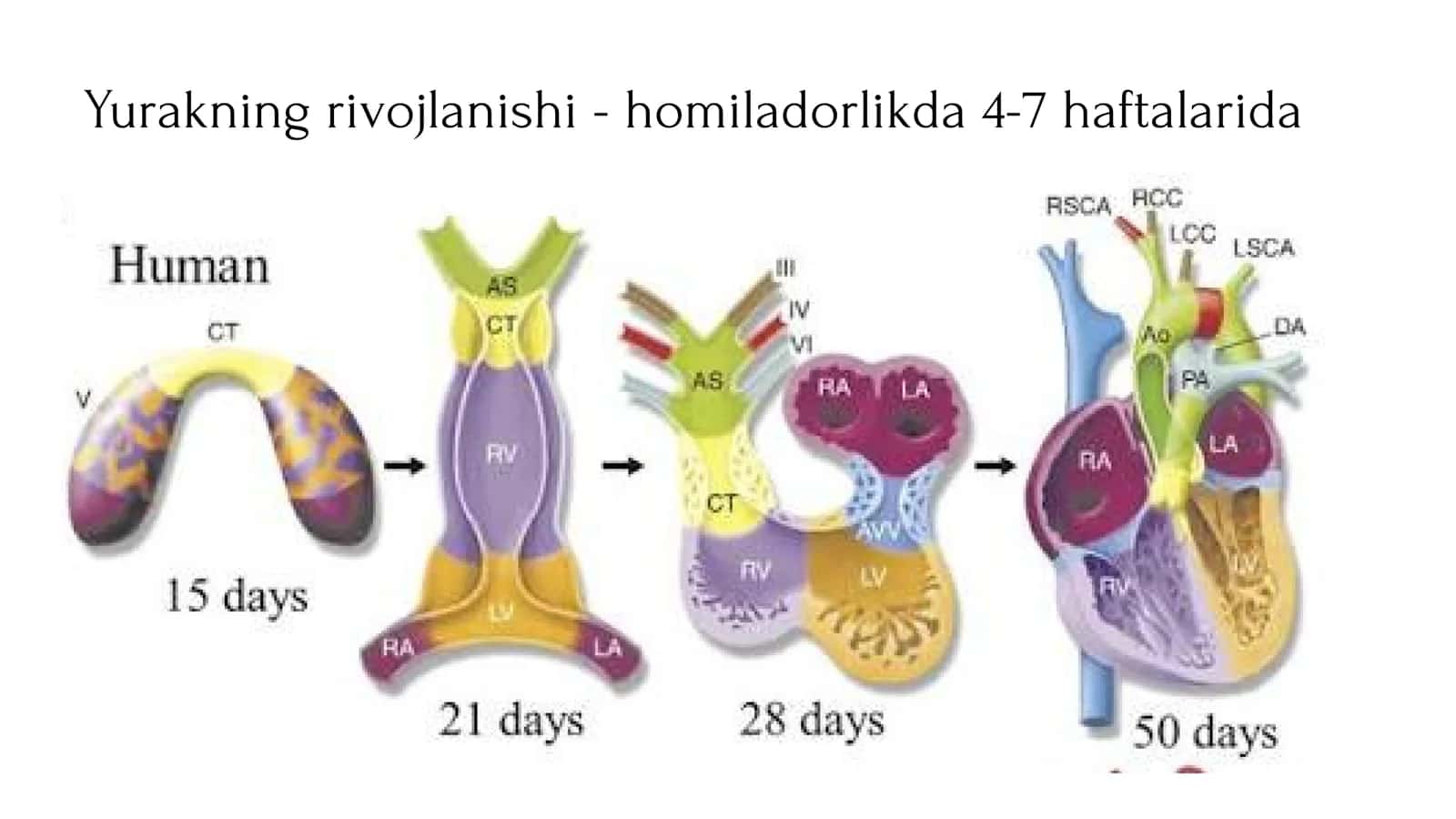 Yurakning rivojlanish nuqsonlari 2