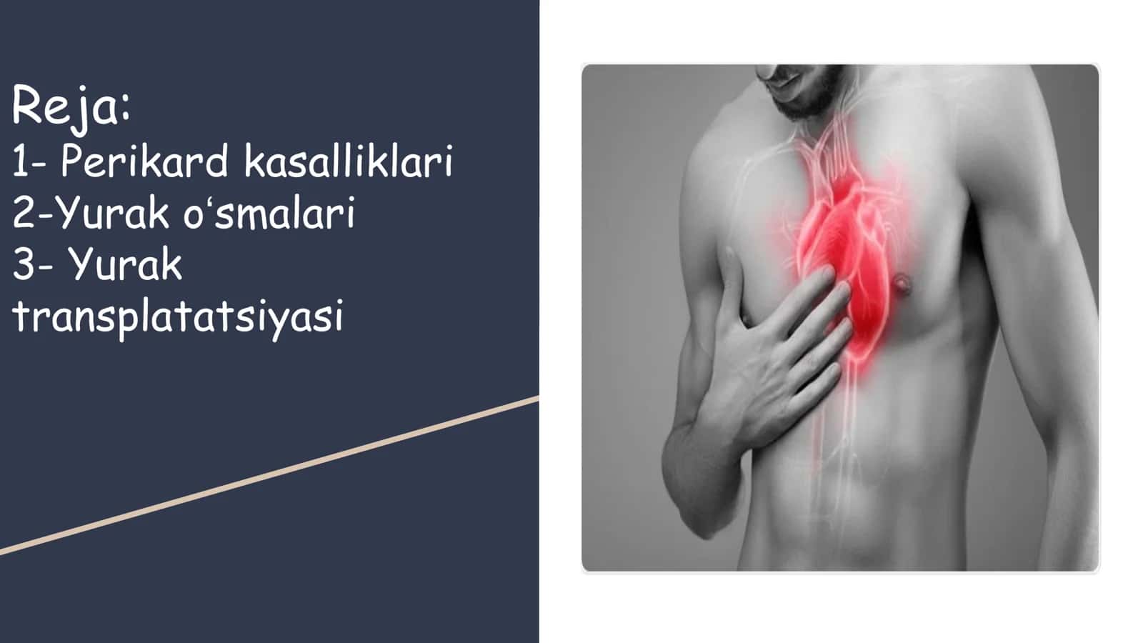 Perikard kasalliklari 2