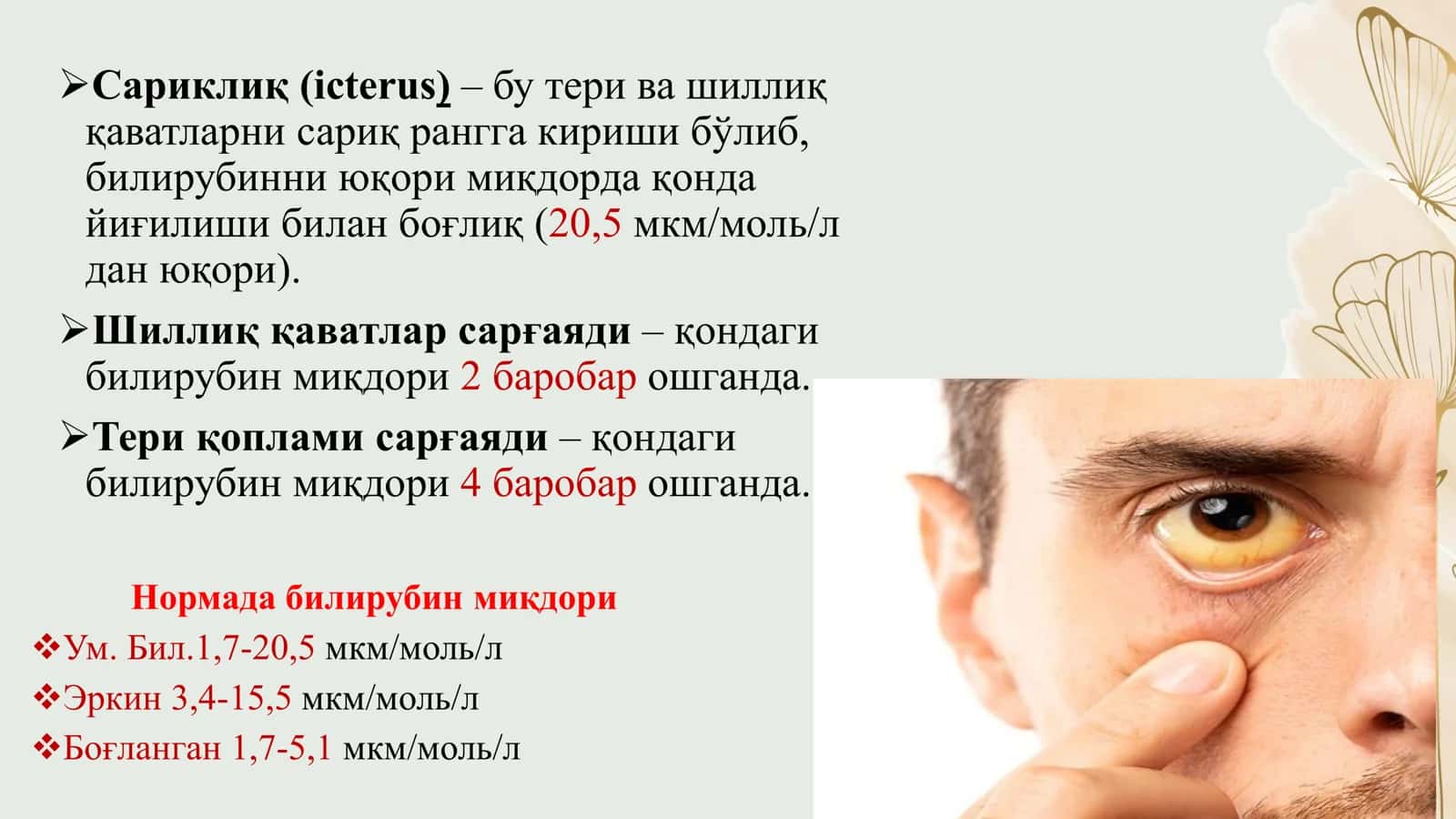 Sariqlik sindromi 2