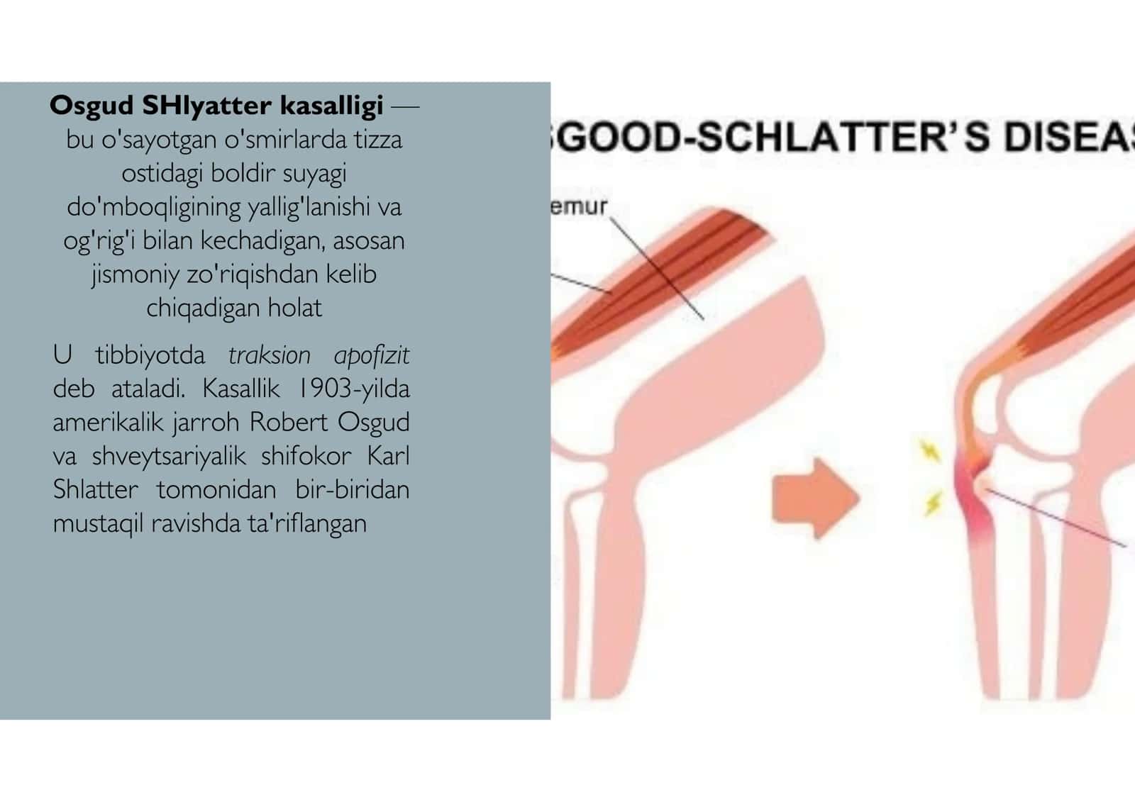 Belgilari va simptomlari 2