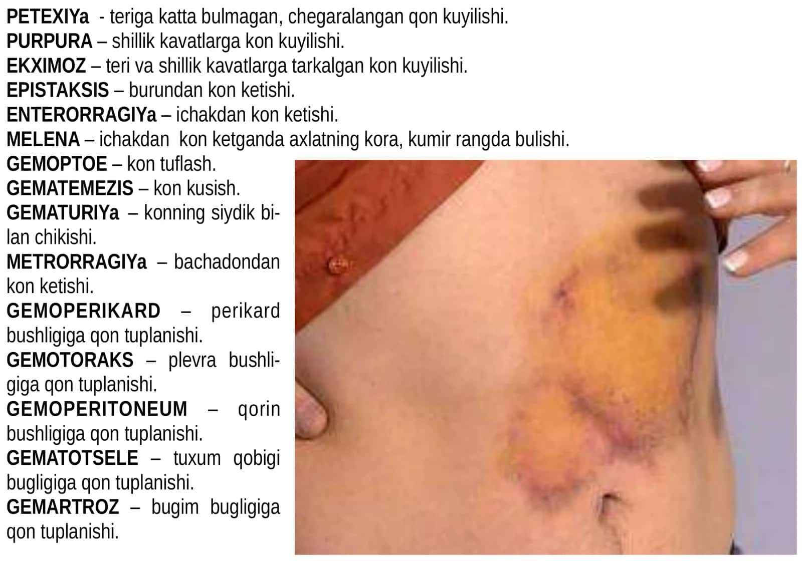QON KETISHI VA UNI TUXTATISH. TRANFUZIOLOGIYA ASOSLARI 2