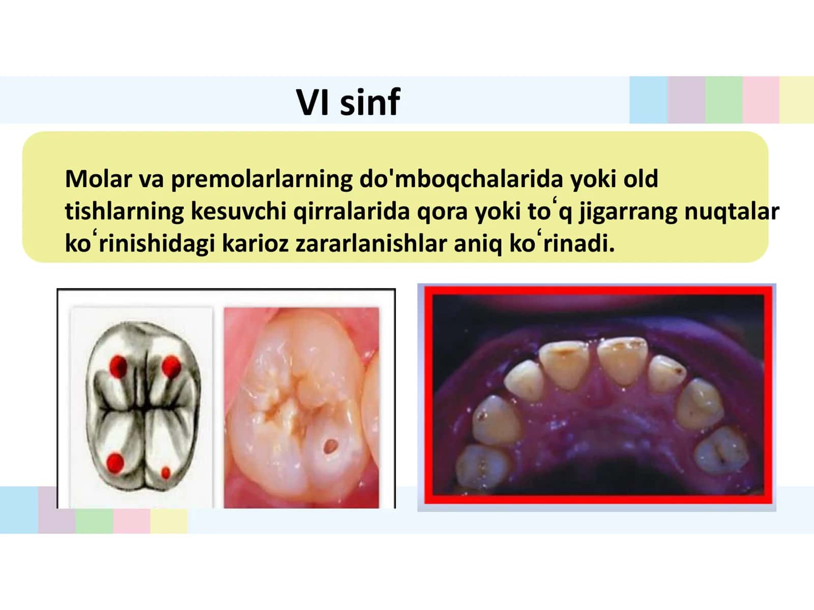 Fantomlarda VIsinf karioz Bo‘s 2