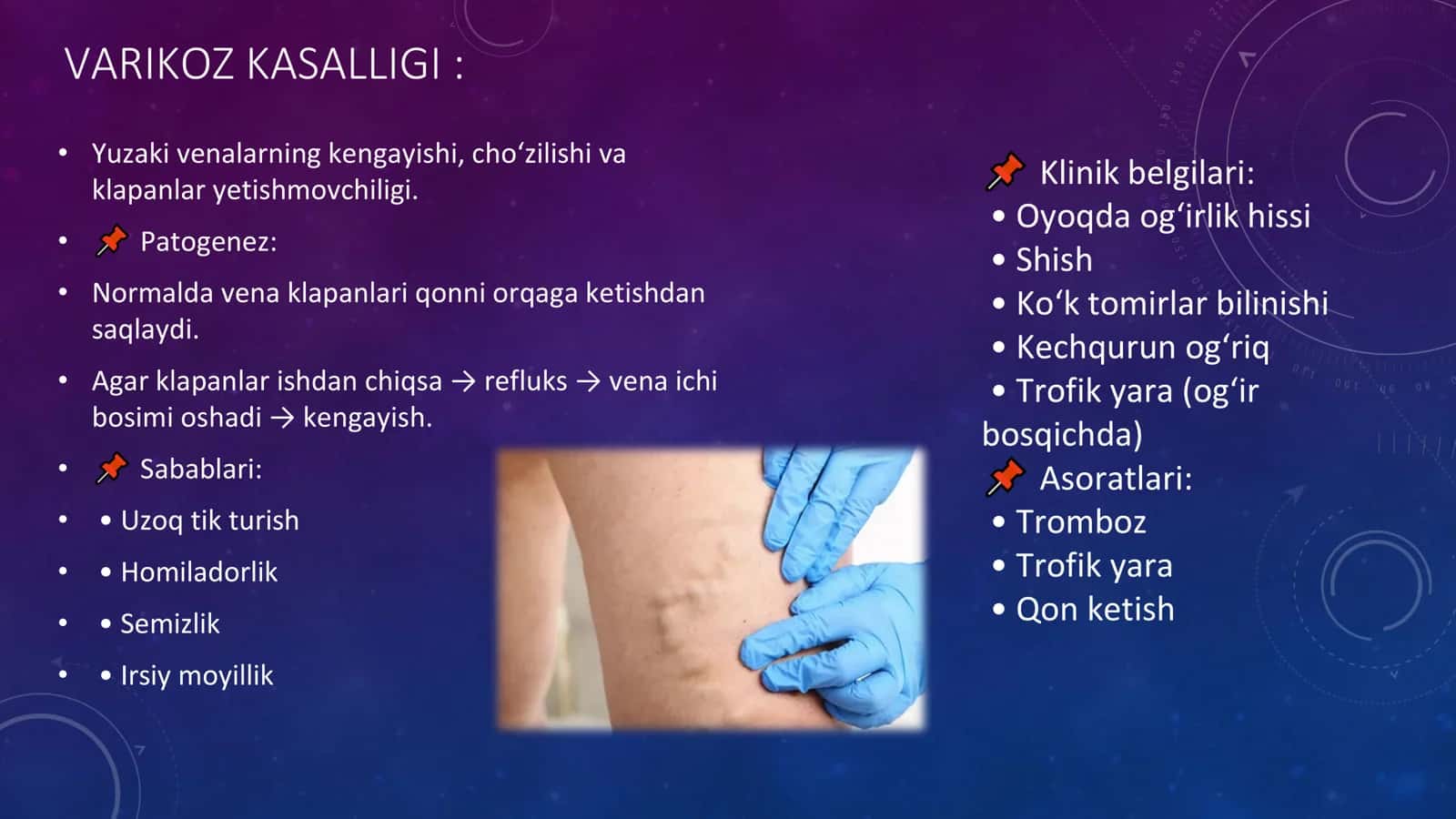 VARIKOZ KASALLIGI 2