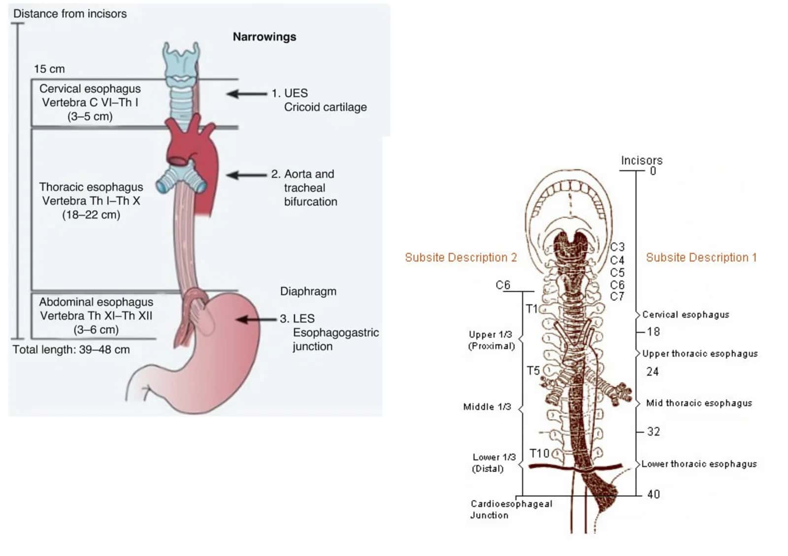 Qiziloʻngach, esophageus. 2