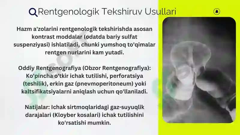 Hazm a’zolarini rentgenologik tekshirish 2