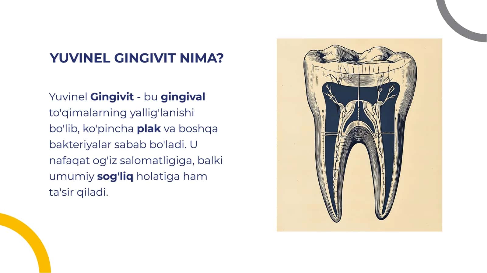 Yuvinel Gingivit 3