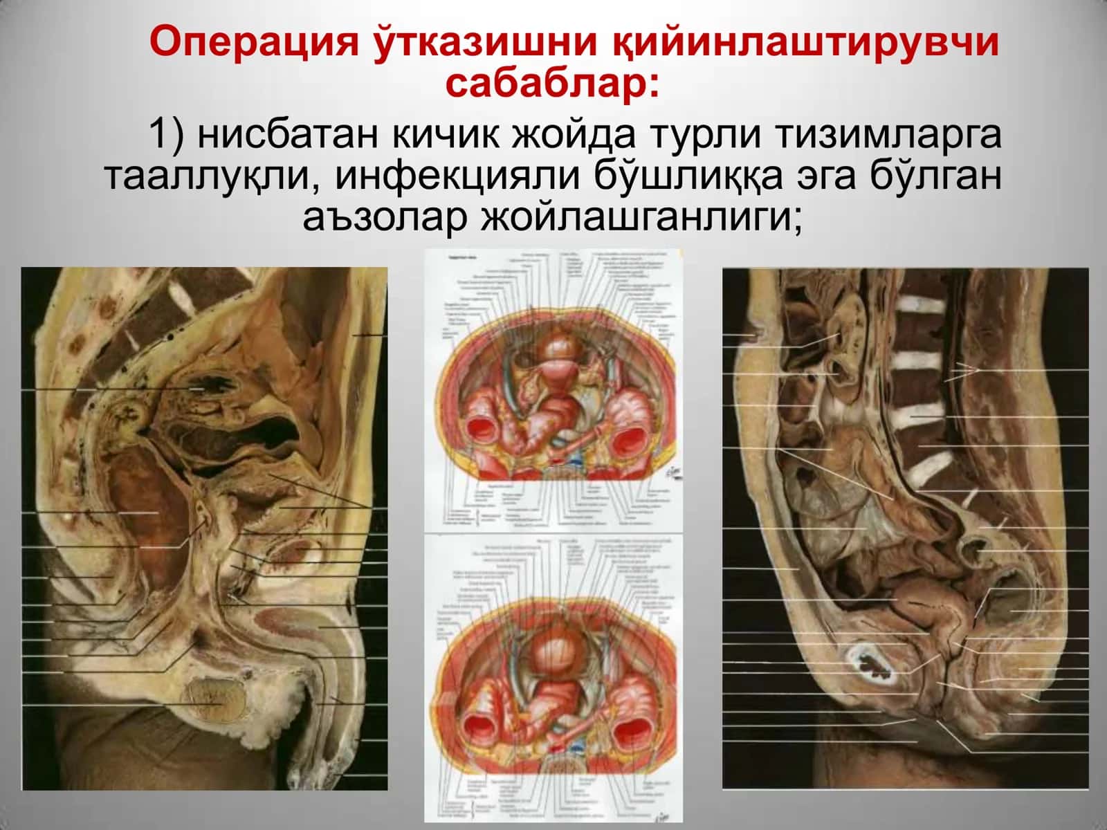 Топографик анатомияси 3