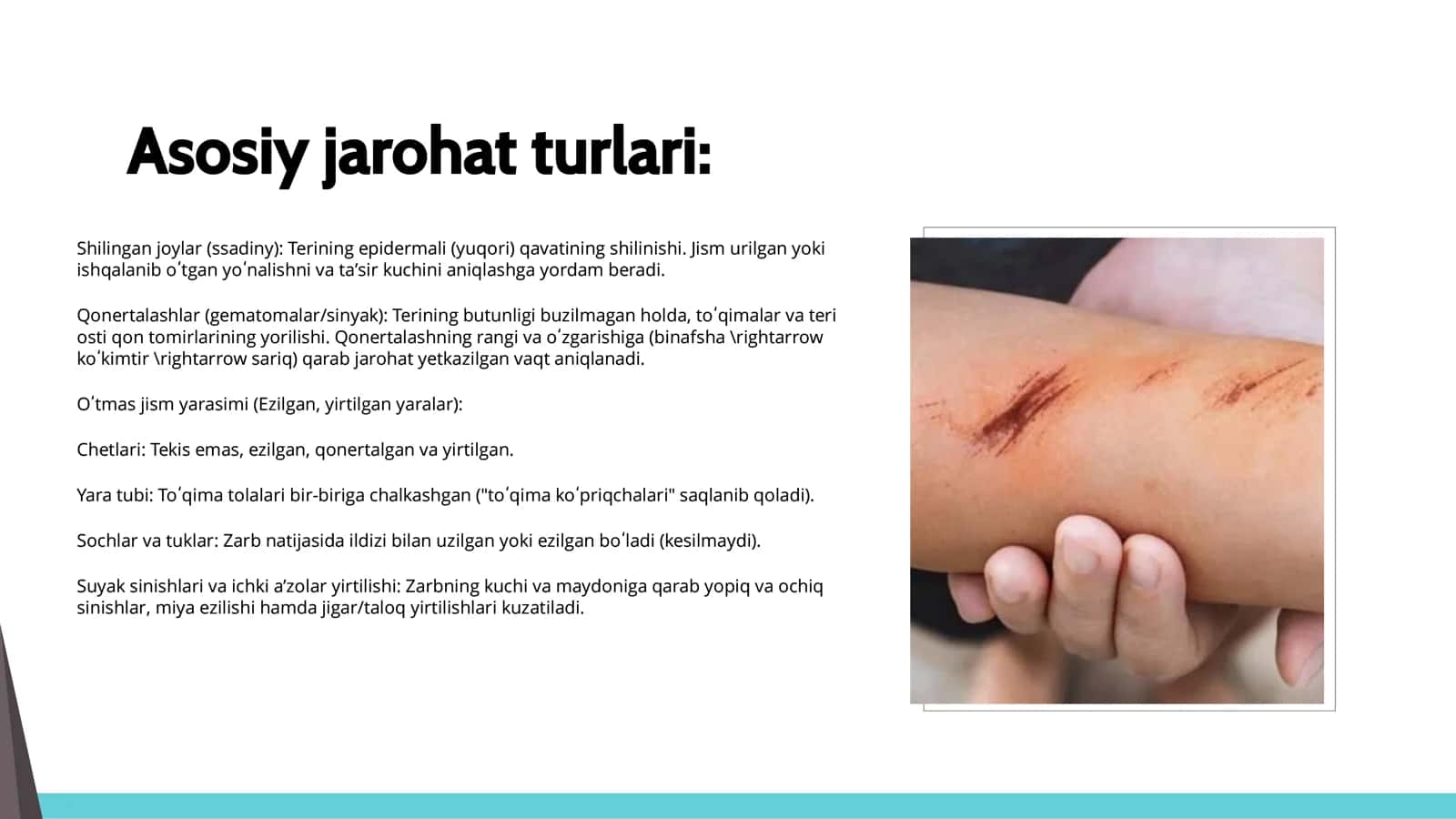 Sud tibbiyoti travmatologiyasi 3