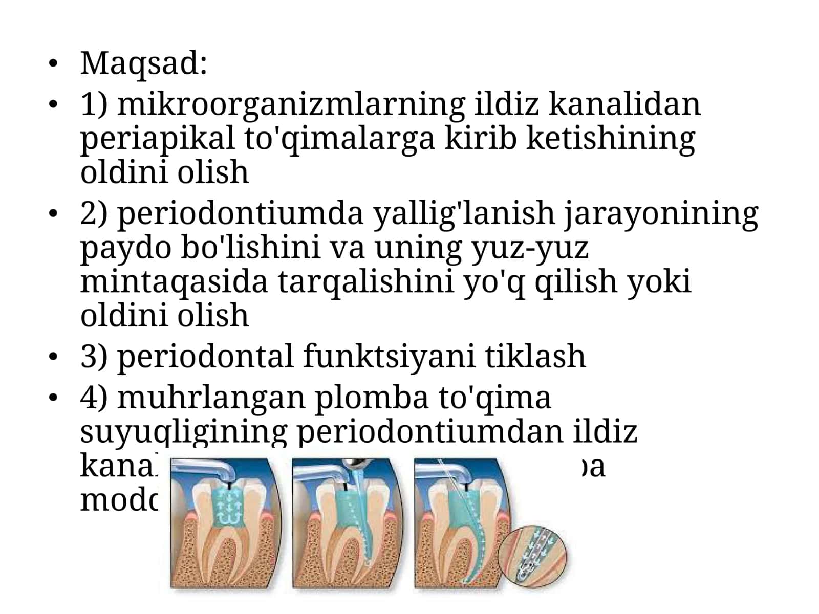 Ildiz kanalini plombalash 3