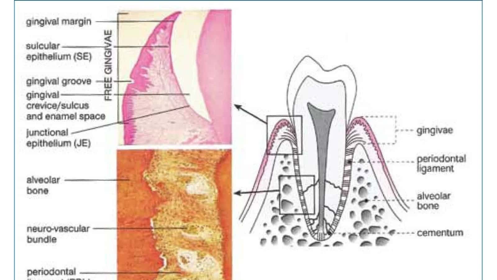 Periodontagi yalligʻlanish jarayoni tish ildizi choqqisi orqali yuqumli toksik mikroblar va toksinla 3