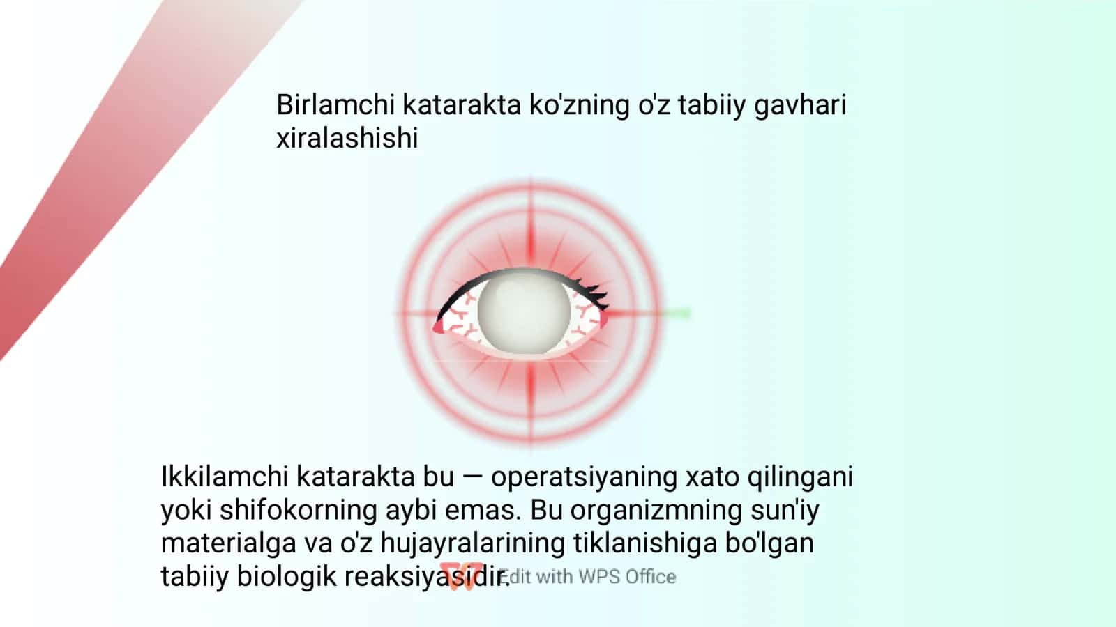 Orttirilgan katarakta 3