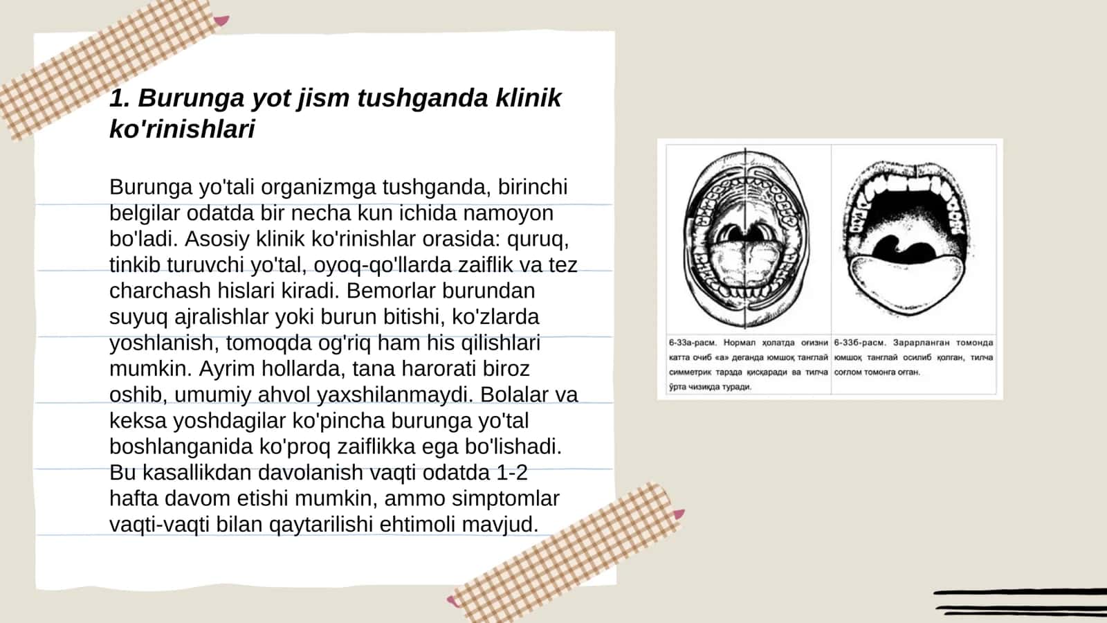Burunga yot jism tushganda klinikasi,etiologiyasi, Differensial tashxis,va davolash 3