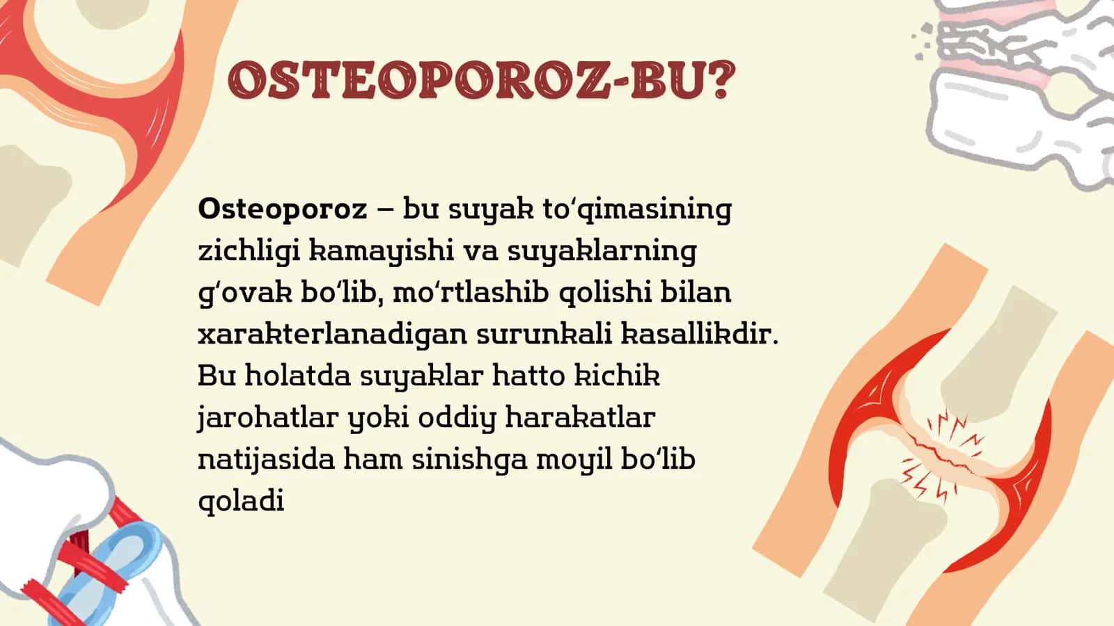 Osteoporoz 3