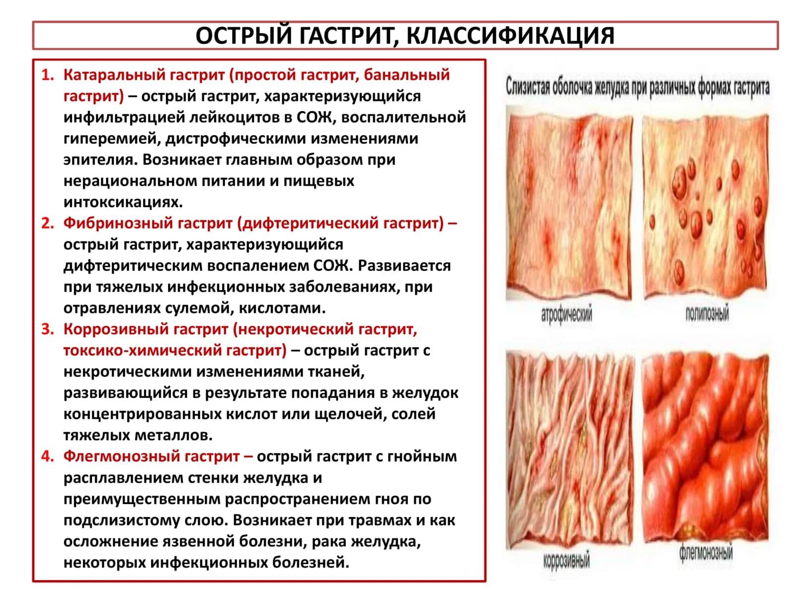 Гастрит 3