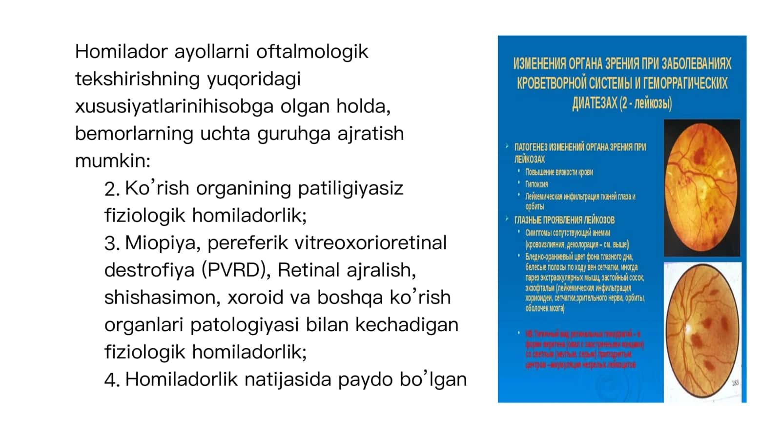 Homilador ayollarda oftalmik 3