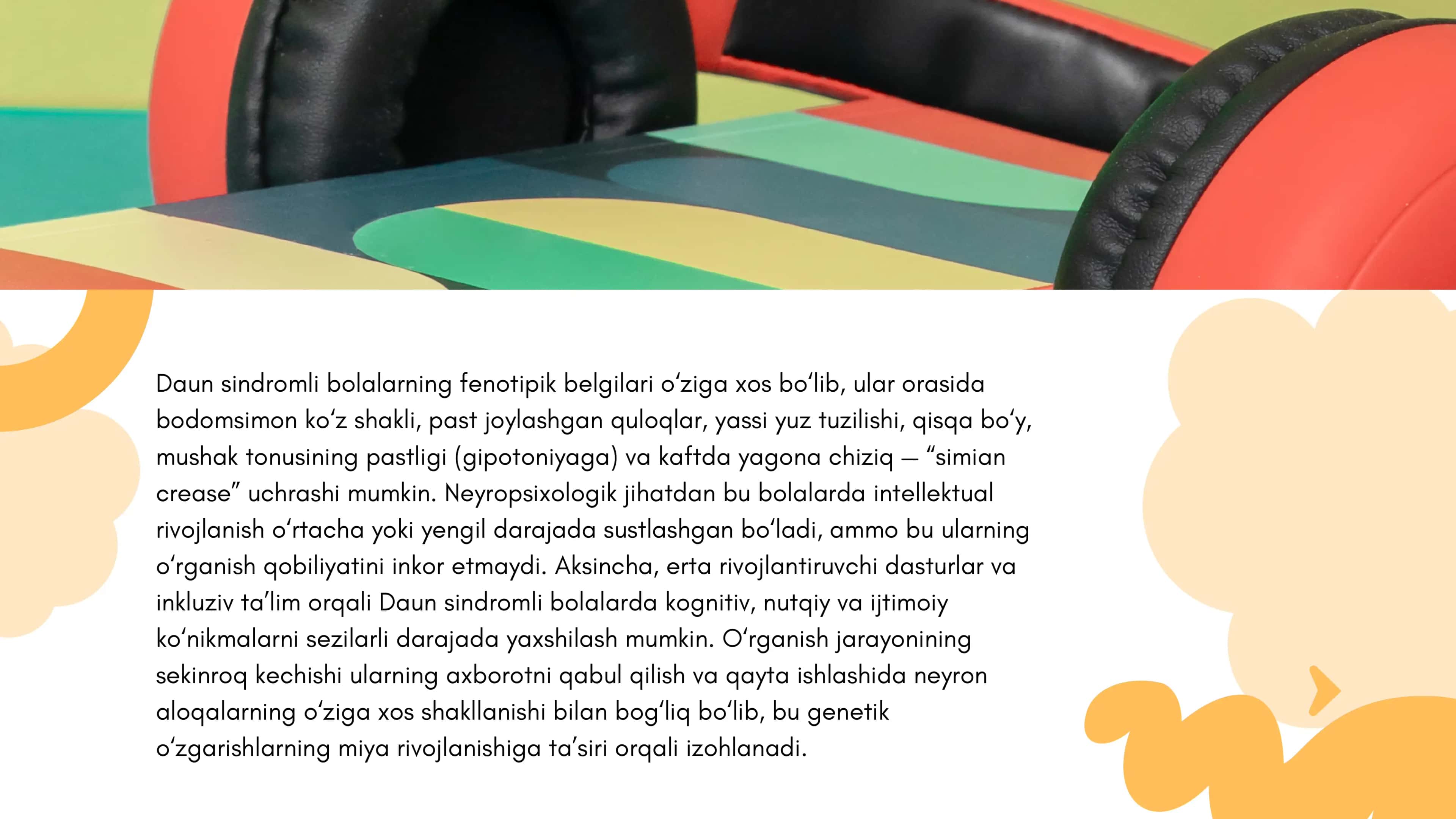 Daun sindromli bolalar 3
