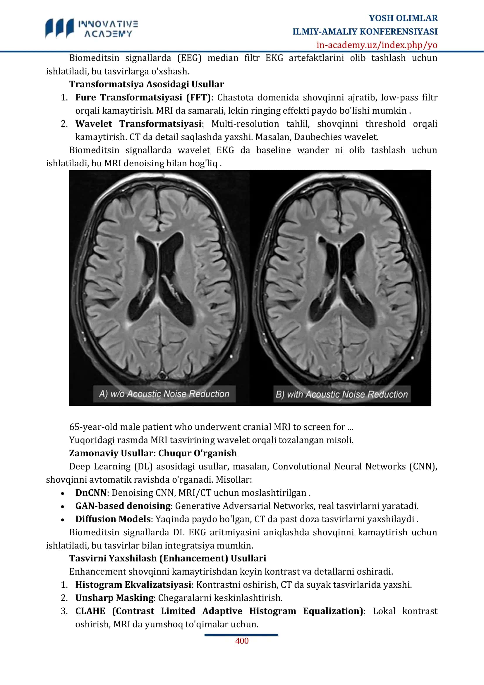TIBBIY TASVIRLARDA (MRI, CT) SHOVQINNI KAMAYTIRISH VA ENHANCEMENT USULLARI 3