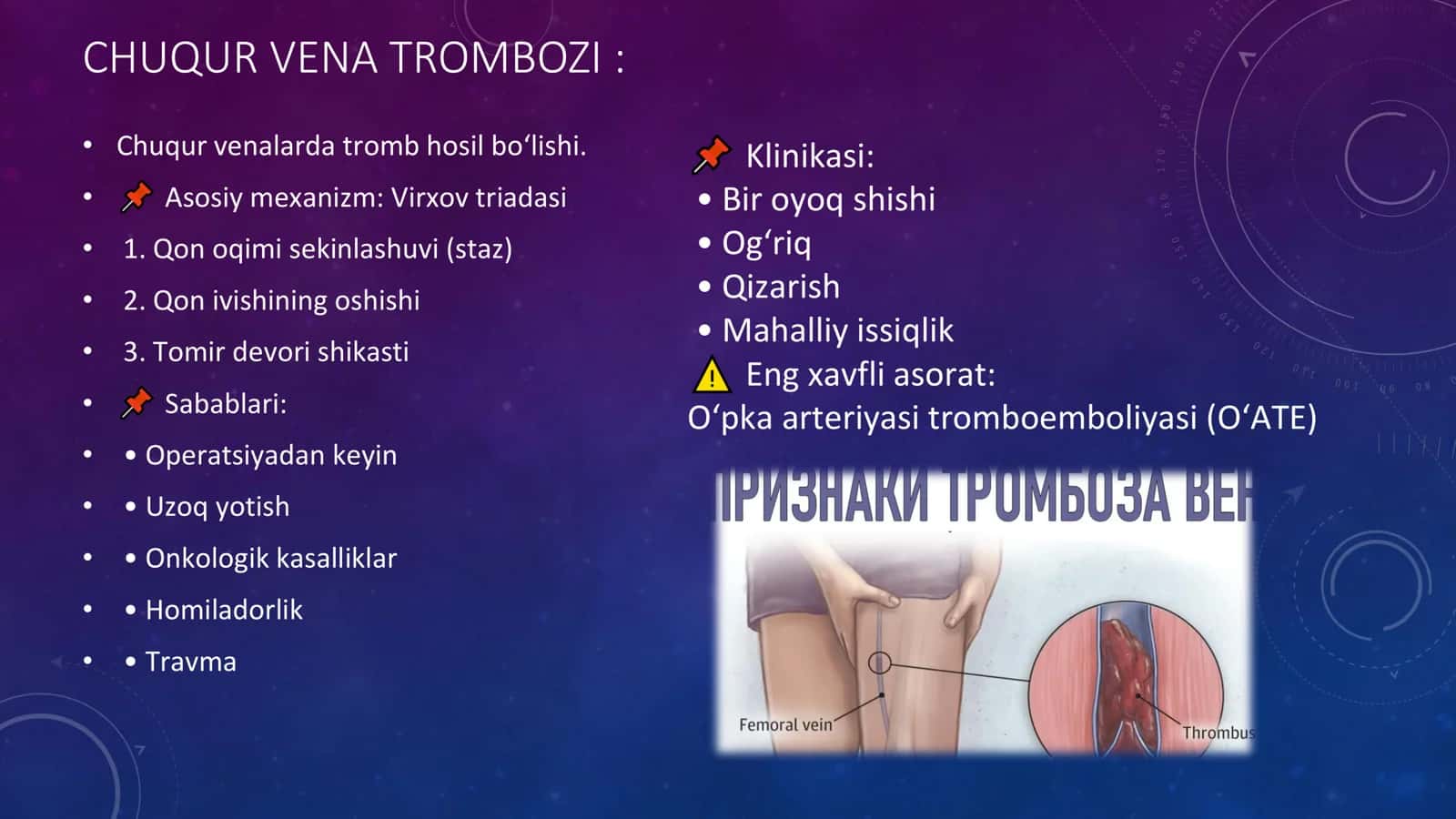 VARIKOZ KASALLIGI 3