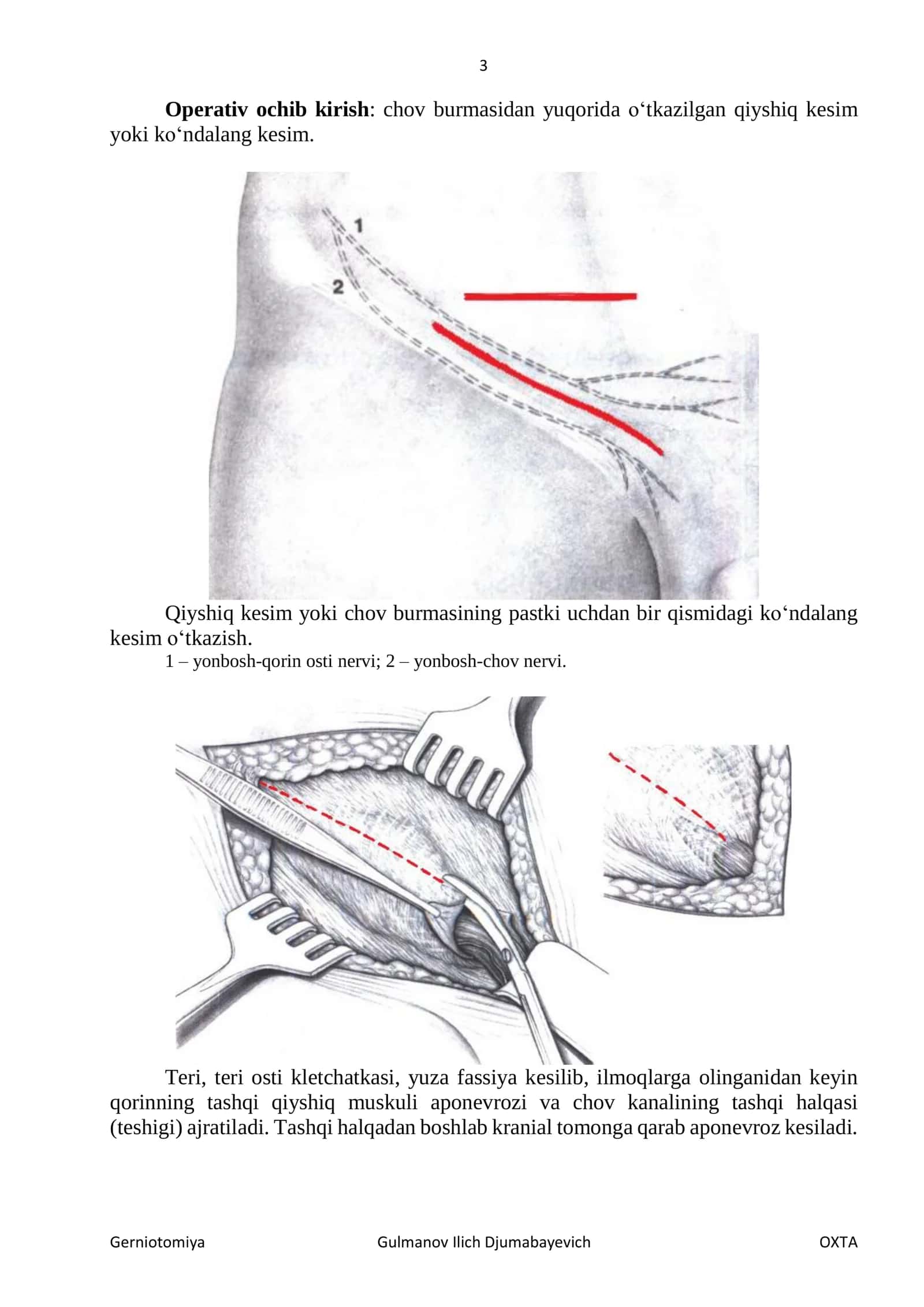 Gerniotomiya 3