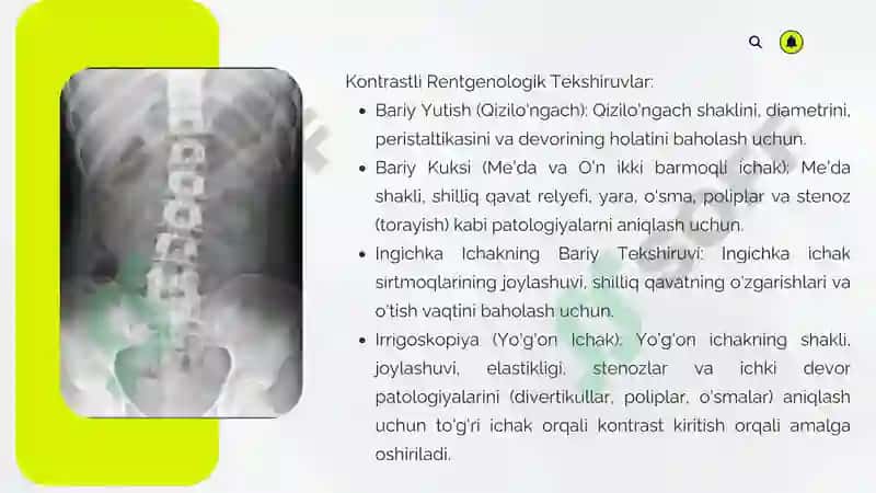 Hazm a’zolarini rentgenologik tekshirish 3