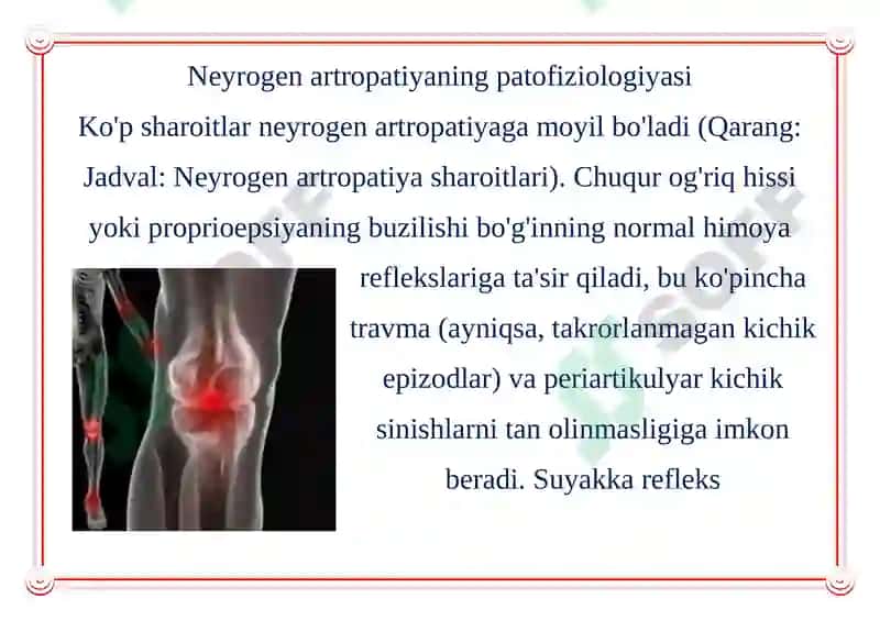 Neyrogen Artropatiya 3