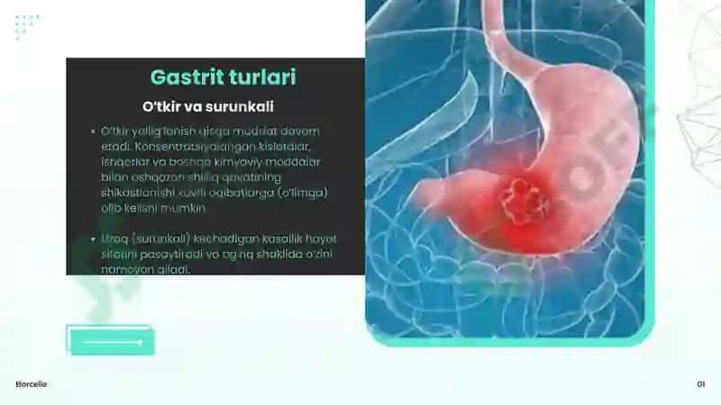 Gastrit kasalligi 4