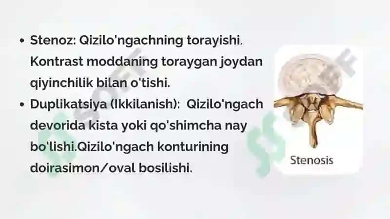 Hazm a’zolarini rentgenologik tekshirish 7