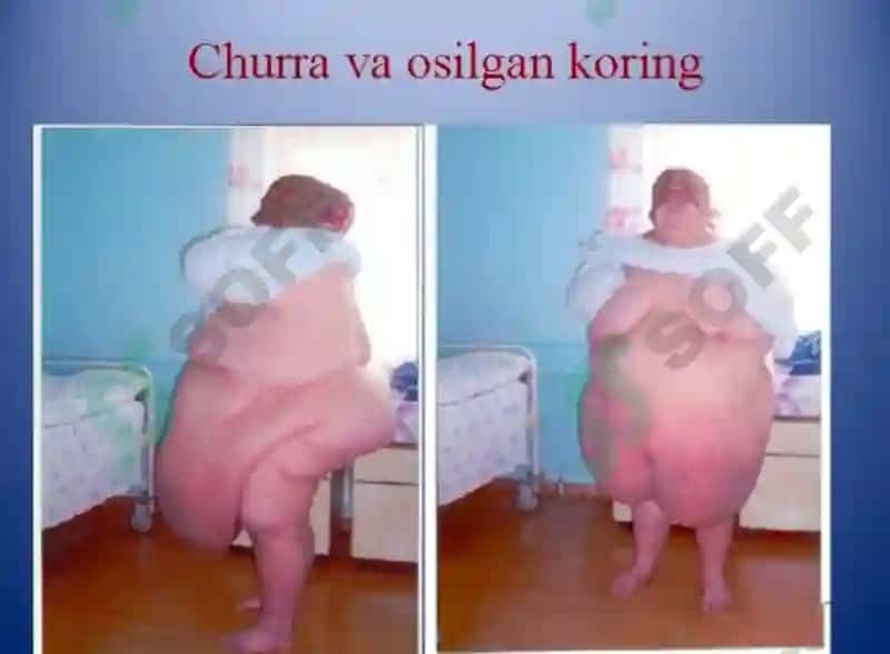 Xirurgiya churralar 7