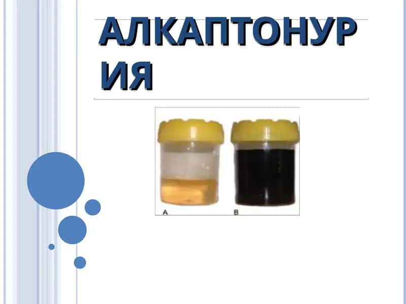 alkoptonuriya genetika 1