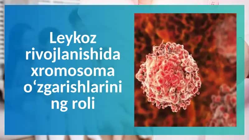 leykozda xromosoma o'zgarishlari 1