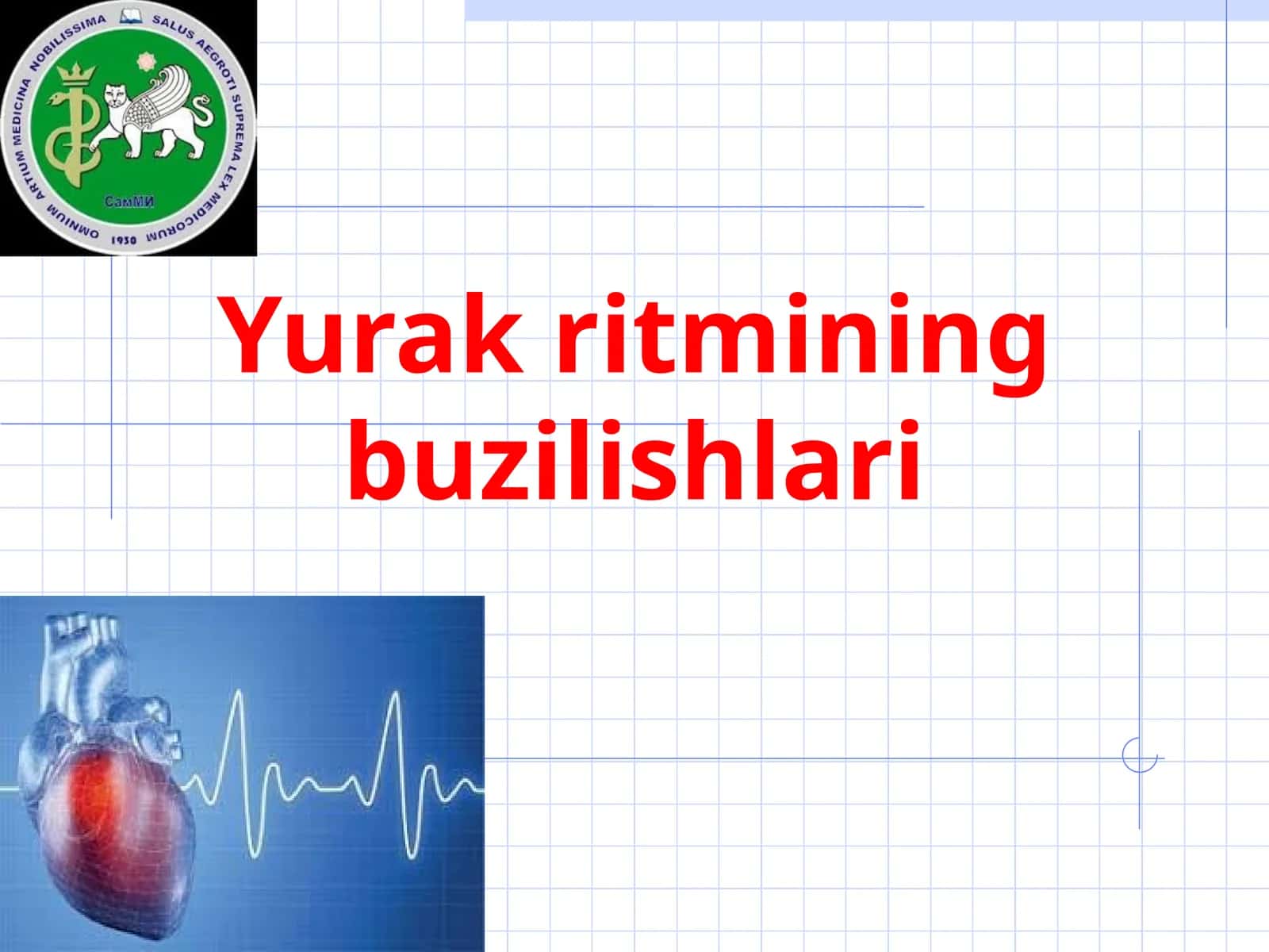 Yurak ritmining buzilishlari 1