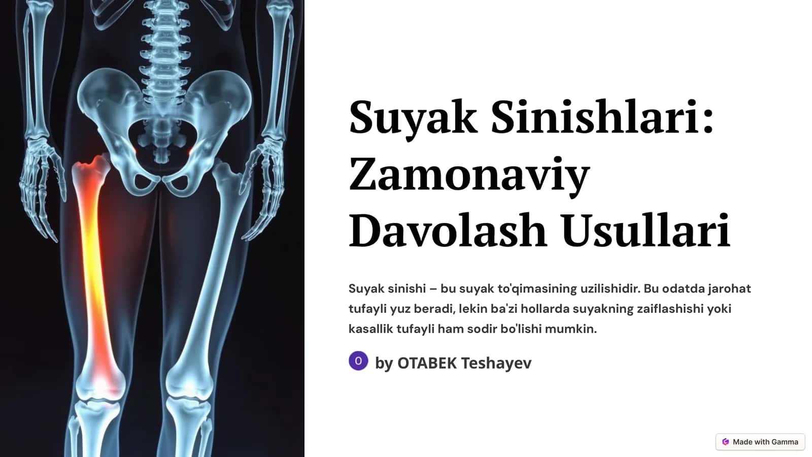 Suyak Sinishlari: Zamonaviy Davolash Usullari 1