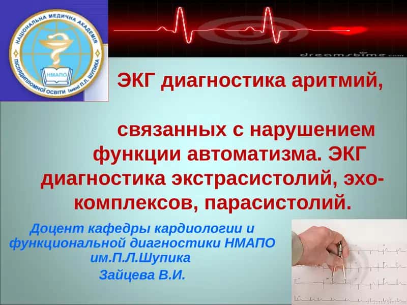 ЭКГ диагностика аритмий 1