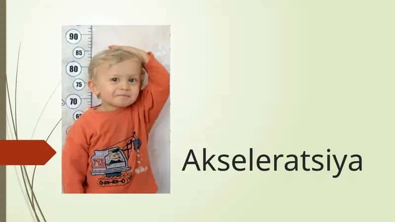 Akseleratsiya 1