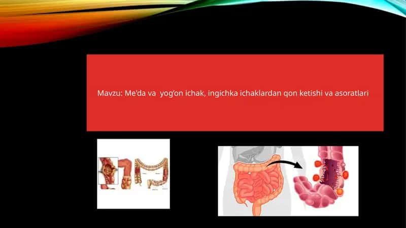 Me'da yog‘on ichak, ingichka ichaklardan qon ketishi va asoratlari 1