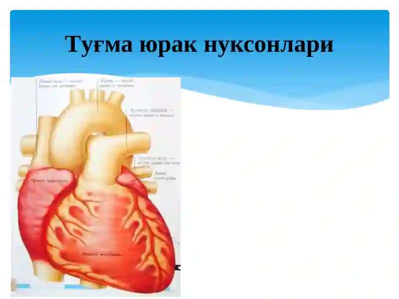 Туғма юрак нуксонлари