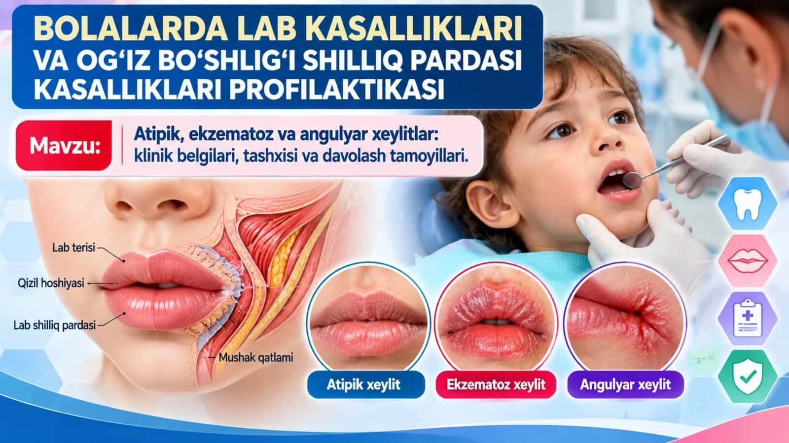 Bolalarda lab kasalliklari Atipik, Ekzematoz va Angulyar xeylitlar Klinik belgilar, tashxis, davolash va profilaktika.pptx 1