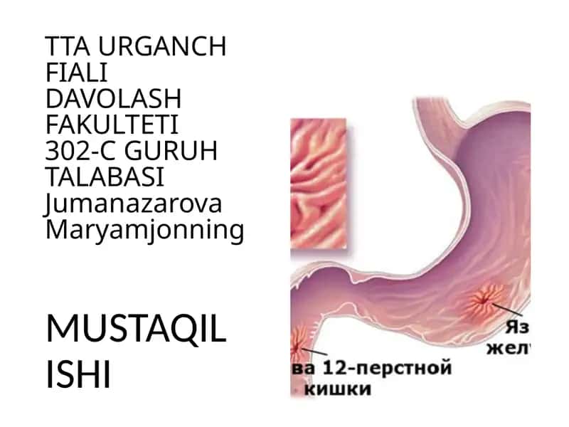 Surunkaligastrit 1