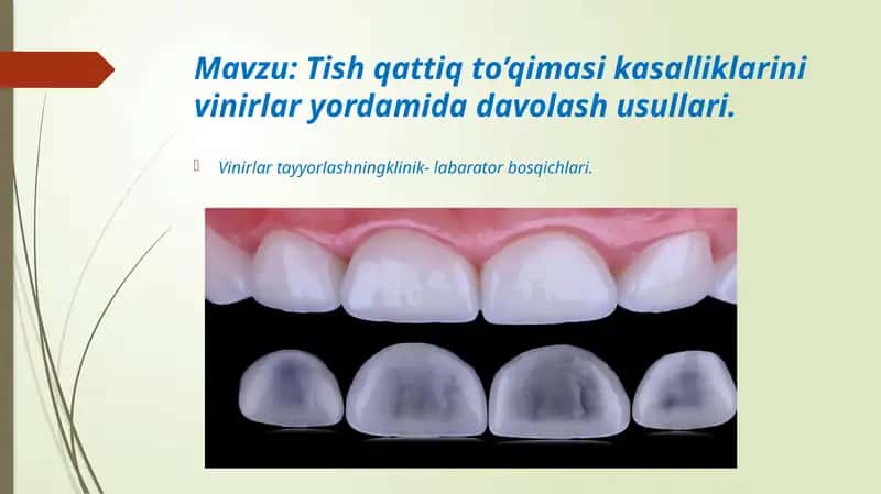 stomatologiyada vinirlar bilan ishlash 1