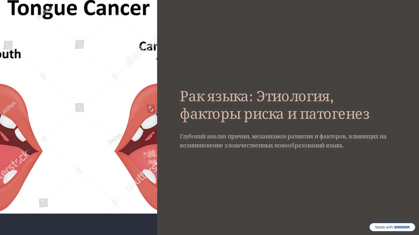 Рак языка: Etiologiya, faktory riska i patogenez 1
