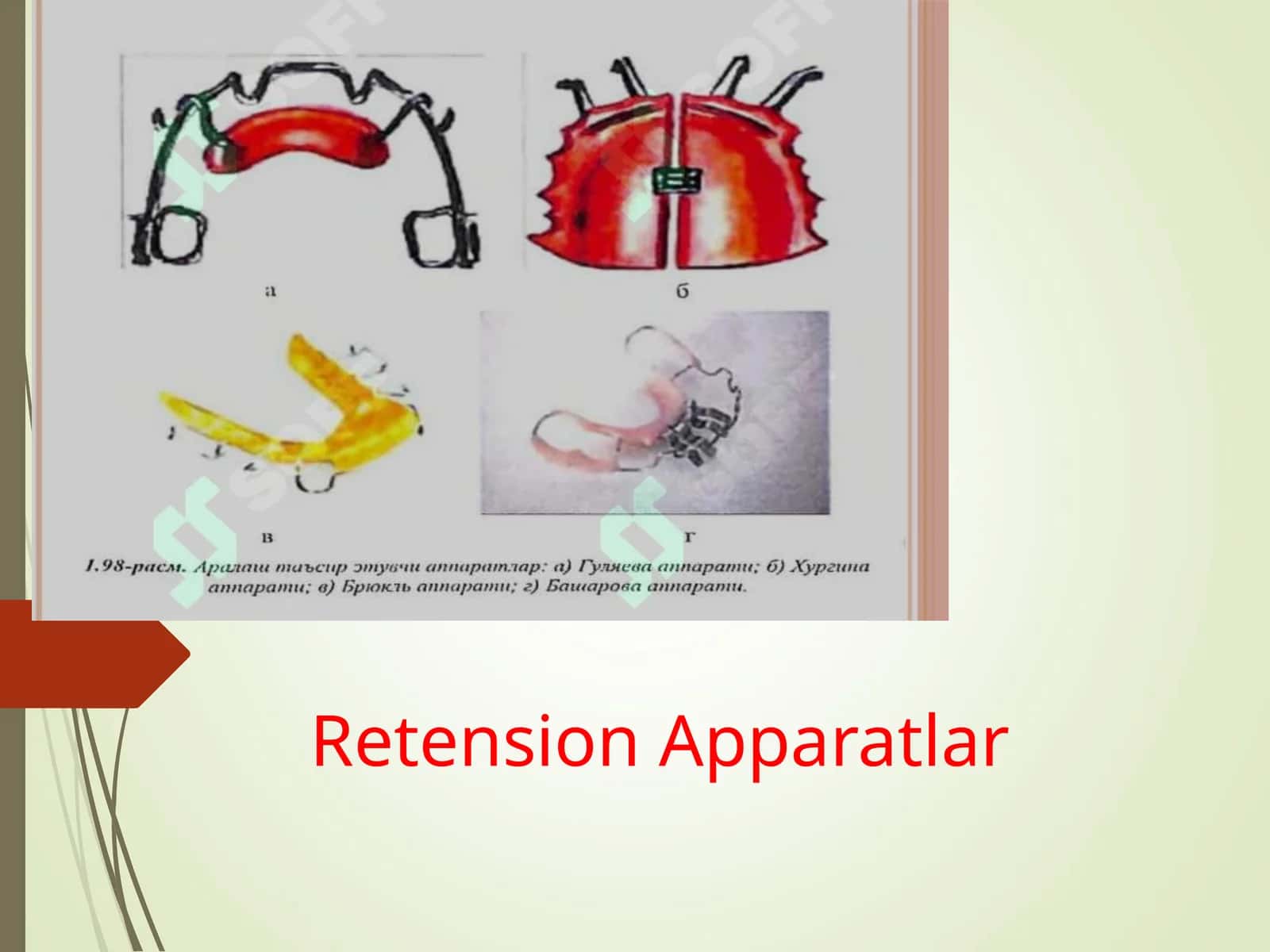 Retension Apparatlar 1