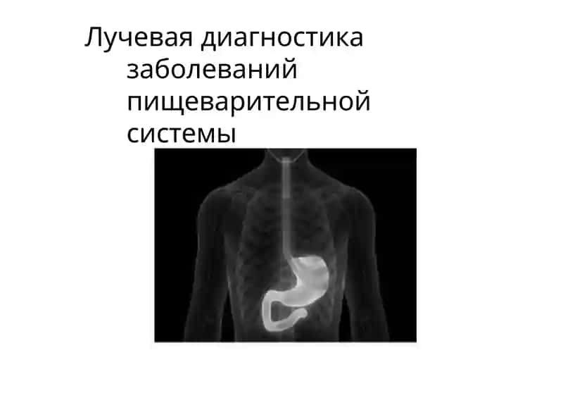 Лучевая диагностика заболеваний пищеварительной системы