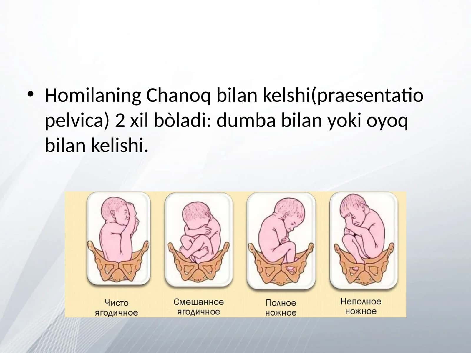 Homilaning Chanoq bilan kelshi(praesentatio pelvica) 1